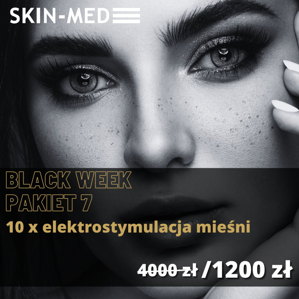 black week